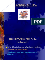 Estenosis Mitral