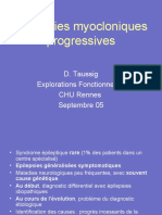 Epilepsies Myocloniques Progressivesneurobretagne Compr