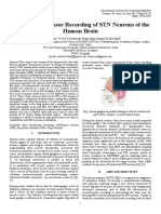 Micro-Neuro-Sensor Recording of STN Neurons of The Human Brain