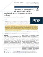 Shear Wave Elastography in Assessment of Liver Stiffness and Prediction of Gastro-Esophageal Varices in Patients With Liver Cirrhosis