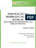 Perfuração Da Membrana Do Seio Maxilar