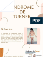 Sindrome de Turner