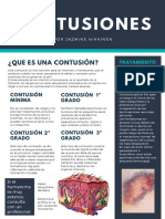 Contusiones Infografía para Impresión