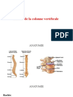 Lesion Colone Vertebrale