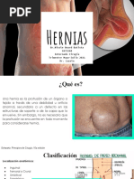 Hernias