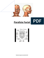 Paralisia Facial