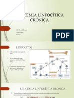 Leucemia Linfocítica Crónica