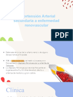 Hipertensión Arterial Secundaria A Enfermedad Renovascular