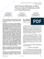 A Case of Eccrine Tumour Metastasis To Spine Managed With Posterior Spinal Stabilization With Recovering Paraparesis