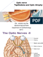 Optic Nerve Pathologies