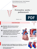 Fereastra Aorto-Pulmonara, Zubco V.