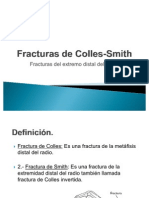 Fracturas de Colles-Smith