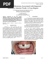 Compound Odontoma Associated With Impacted Maxillary Anterior Teeth A Case Report