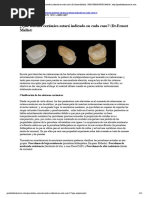 ¿Qué Sistema Cerámico Estará Indicado en Cada Caso