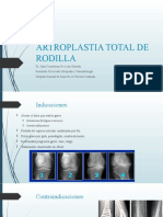 Artroplastia Total de Rodila