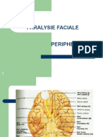 2 - Paralysie Fasciale