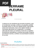 Derrame Pleural