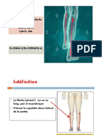 La Fibula