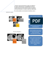 Intraperitoneal