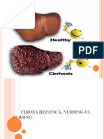 Ciroza Hepatica 2021