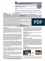 Submental Flap in Head and Neck Reconstruction An Alternative To Microsurgical Flap - February - 2020 - 1580559115 - 2824301