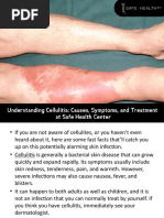 Cellulitis Causes, Symptoms and Treatment at Safe Health Center in MT Pleasant, MI