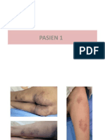 Pasien - 1 - Tinea Kruris Et Korporis