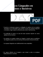 Apoyos Linguales en Caninos e Incisivos 74-80