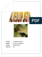 Alveoloplastia