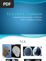 TCE, AVE e Epilepsia