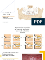 Desar de La Oclusion Infantil Juan Vasquez