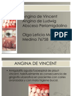 Angina de Vicent