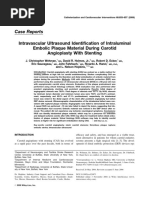 Case Reports Intravascular Ultrasound Identification of Intraluminal Embolic Plaque Material During Carotid Angioplasty With Stenting