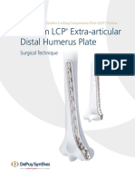 3.5 MM LCP Extra-Articular Distal Humerus Plate: Surgical Technique