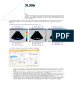 Dynamic Depth Focussing