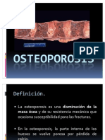 Osteoporosis