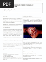 Histiocitosis de Celulas de Langerhans Informe de Un Caso: Velásquez Zapata, Gloria Elena Correa, Luis Alfonso