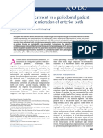 Orthodontic Treatment in A Periodontal Patient With Pathologic Migration of Anterior Teeth