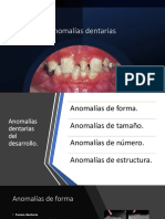 Anomalías Dentales