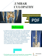 Lumbar Radiculopathy