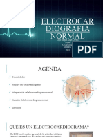 Electrocar Diografia Normal: Cayo Miguel Angel Leveau Lujan R2 Cardiologia Hnerm 2018