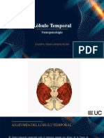 Alteraciones Lóbulo Temporal