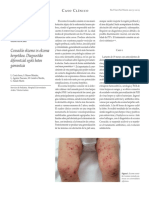 Eccema Coxsackie Vs Eccema Herpético. La Importancia de Un Correcto Diagnóstico Diferencial