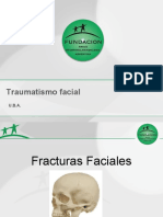 Traumatismo Facial