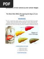 Symptoms of Liver Cancer - Liver Cancer Stages