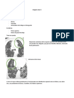 Clase 5 PLEURA