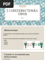 2.3 Histerectomía Tipos: Equipo 4