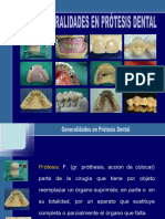 Generalidades en Protesis Dental