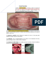 Cirugia Pre-Protesica