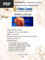 Herpes Zoster